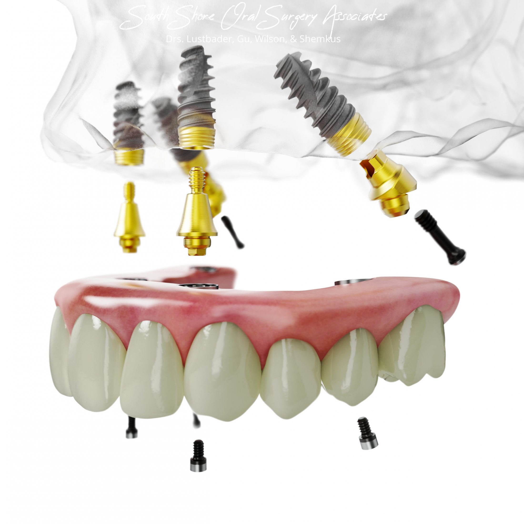 South Shore Oral Surgery Associates All-On-4 Center of Excellence