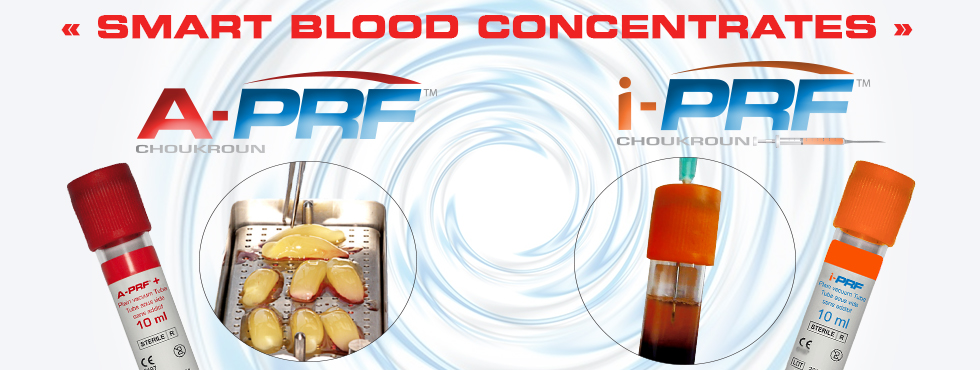 DDP PRF & GRF System Dental Implant Kit - Platelet Rich Fibrin, Stainless Steel, DN-316