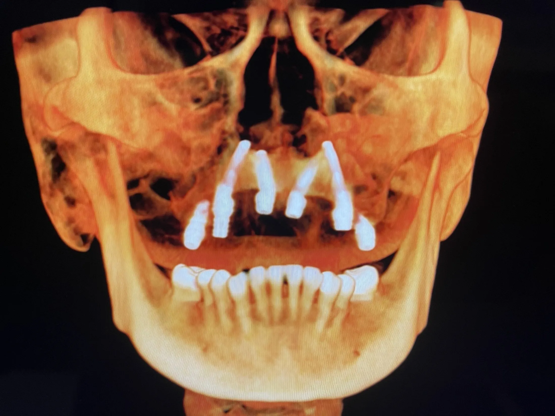 South Shore Oral Surgery Dr.Michael Gu All On 4 expert