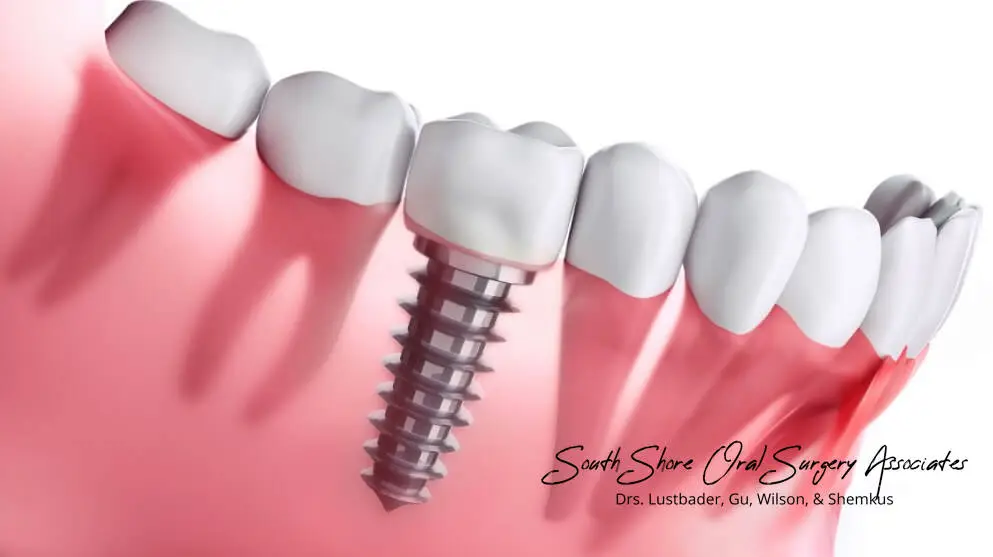South Shore Oral Surgery Associates of Quincy Dental Implants